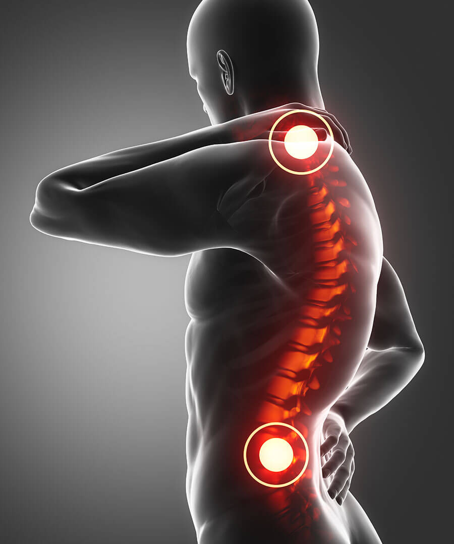 Spine injury pain in sacral and cervical region concept